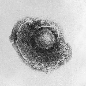 这种病毒一旦感染 一辈子无法摆脱：1个方法提前预防
