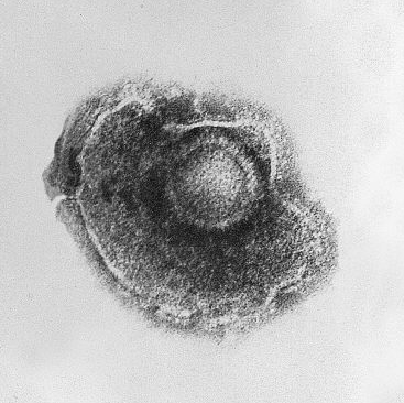 这种病毒一旦感染 一辈子无法摆脱：1个方法提前预防  第1张