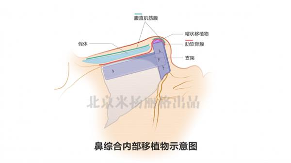  巫文云院长论文《自体肋软骨改善鼻尖形态的效果》发表于国家学术期刊上 第2张