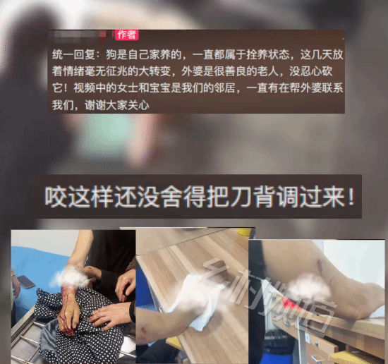 老人手臂被家养狗撕咬：手中握刀不舍得砍 网友唏嘘不已  第2张