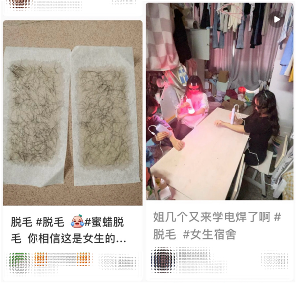 有的女生体毛比男生还多：小心这种病！